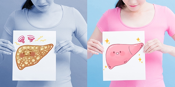 کبد چرب غیر الکلی، مکمل های غذایی و گیاه درمانی