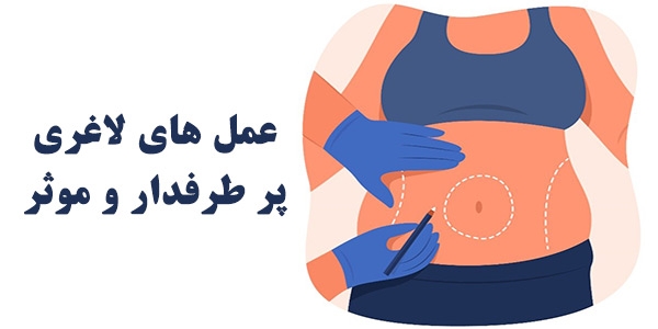  انواع عمل لاغری پرطرفدار و موثر؛ کدام یک بهتر است؟