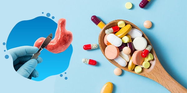 مکمل های لازم برای بعد از عمل لاغری