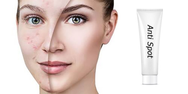 بهترین کرم ضد لک بدون بازگشت ایرانی