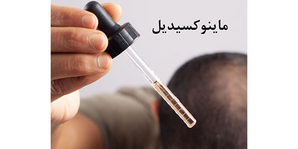 ماینوکسیدیل: همه چیز درباره این دارو برای رشد مو