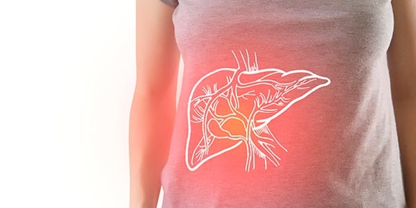 کبد چرب چیست؟