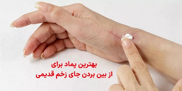 بهترین پماد برای از بین بردن جای زخم قدیمی