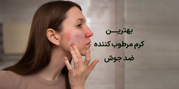 بهترین کرم مرطوب کننده ضد جوش