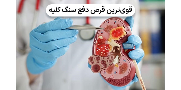 قوی‌ترین قرص دفع سنگ کلیه