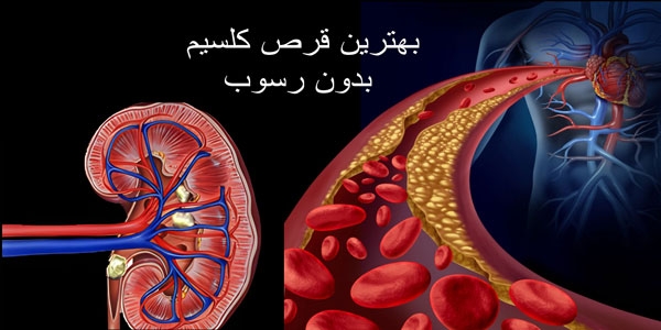 بهترین قرص کلسیم بدون رسوب