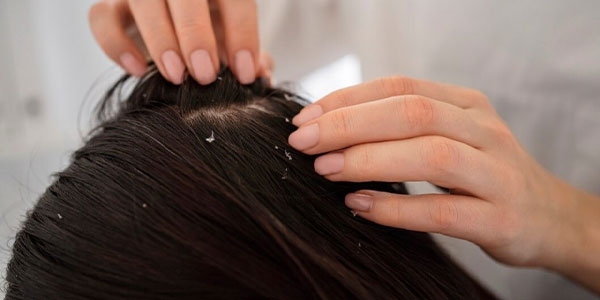 بهترین شامپو تقویت کننده و ضد شوره