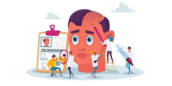 بهترین شامپو برای بعد از کاشت مو