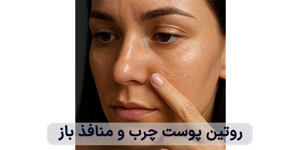 روتین پوست چرب و منافذ باز
