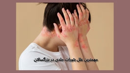 مهمترین علل بثورات جلدی در بزرگسالان