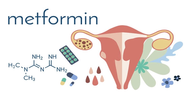 فواید قرص متفورمین برای تنبلی تخمدان