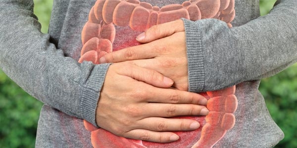 سندروم روده تحریک پذیر چیست؟