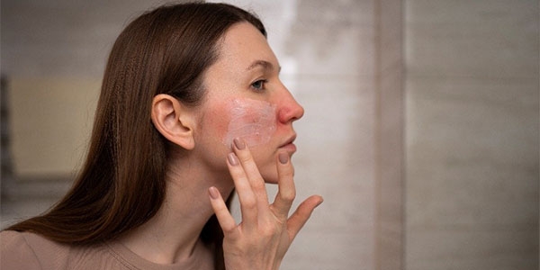 آیا درمان خشکی پوست با مکمل خوراکی امکان‌پذیر است؟