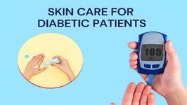 مراقبت از پوست در بیماران دیابتی