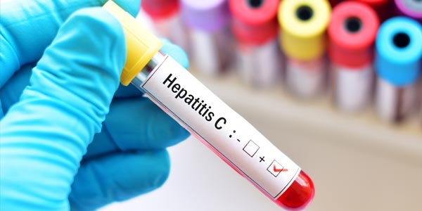 همه چیز درباره هپاتیت C