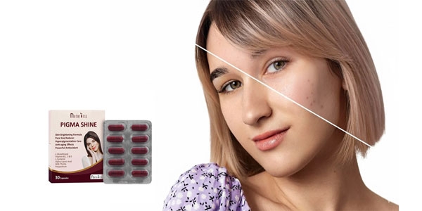 بررسی علمی بهترین مکمل‌های خوراکی ضد لک و روشن کننده پوست؛ مکمل پیگما شاین