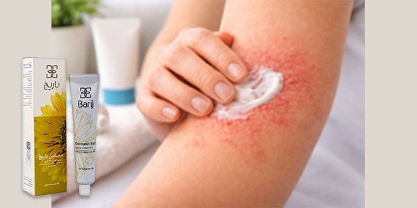 بهترین کرم برای درمان درماتیت