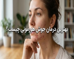بهترین درمان جوش هورمونی چیست؟