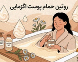 روتین حمام پوست اگزمایی