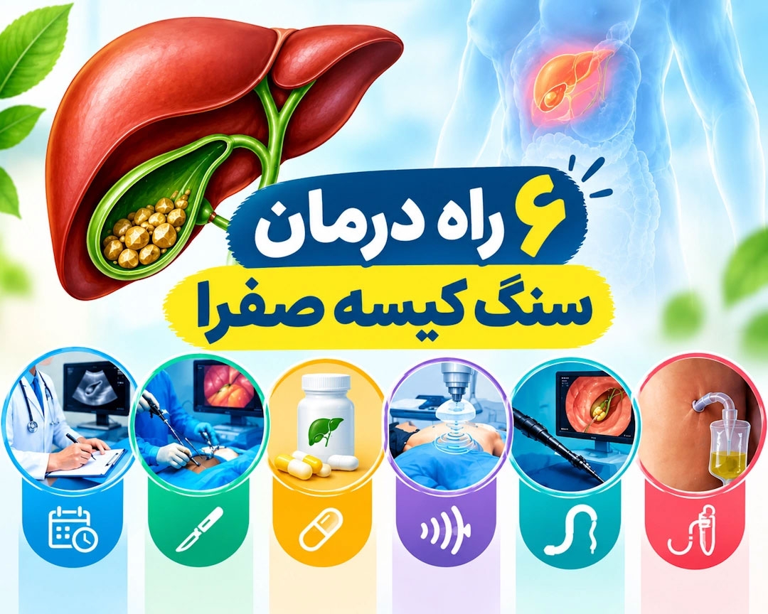 6 راه درمان سنگ کیسه صفرا