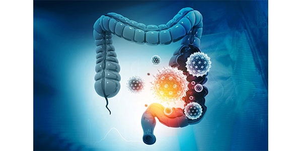 اسهال و ویروس های گوارشی