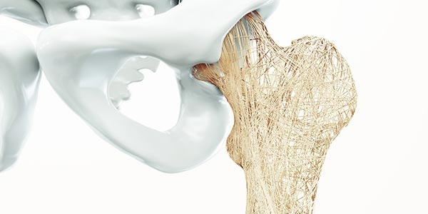 رپورتاژ- مصرف مکمل برای جلوگیری از پوکی استخوان