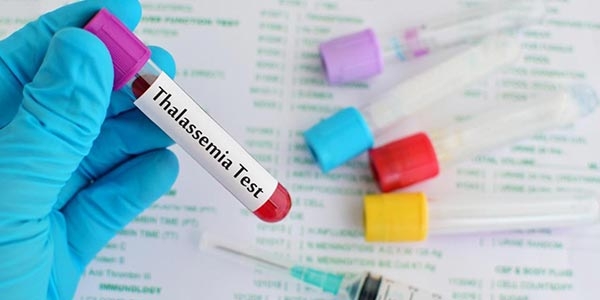 تالاسمی چیست