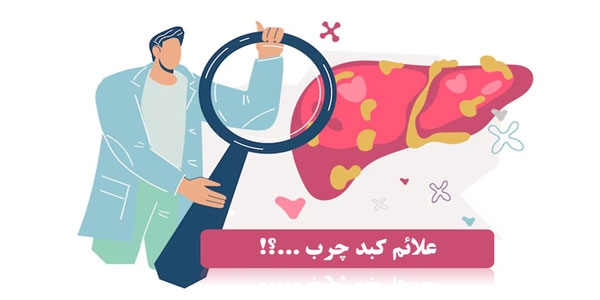 علائم کبد چرب چیست؟