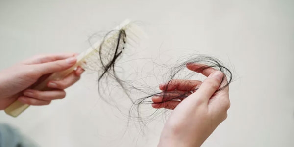 چرا ریزش مو دارم؟