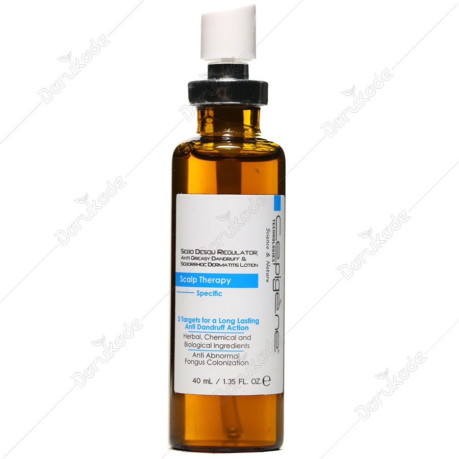 محلول ضد شوره چرب و درماتیت سبوریک نیو