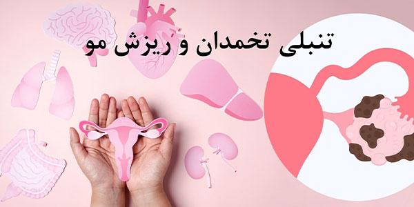 ریزش مو به خاطر کیست تخمدان؟ دلایل و راهکارهای درمانی موثر