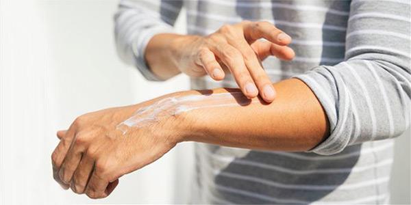 درمان سریع آفتاب سوختگی دست ها